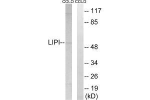 Western blot analysis of extracts from COLO cells, using LIPI antibody. (Lipase I 抗体  (Internal Region))