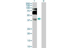 Western Blot analysis of SQSTM1 expression in transfected 293T cell line by SQSTM1 MaxPab polyclonal antibody. (SQSTM1 抗体  (AA 1-440))