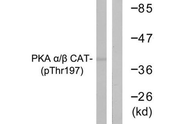 PRKACA 抗体  (pThr197)