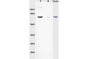 L1 human colon carcinoma lysates L2 rat brain lysates probed with Anti KIFC1 Polyclonal Antibody, Unconjugated (ABIN873143) at 1:200 overnight at 4 °C. (KIFC1 抗体)