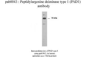 PADI1 抗体