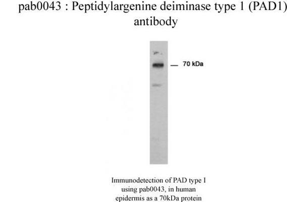 PADI1 抗体