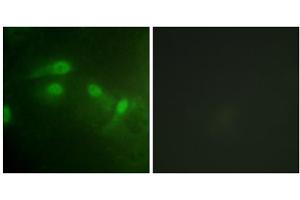 Immunofluorescence analysis of HeLa cells, using MDM2 (Phospho-Ser186+Ser188) antibody. (MDM2 抗体  (pSer186, pSer188))