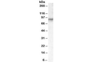 Western blot testing of human placenta lysate with Factor XIIIa antibody at 0. (F13A1 抗体)