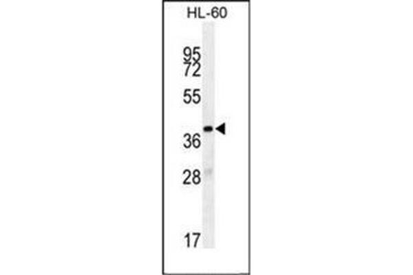 OR10J5 抗体  (C-Term)