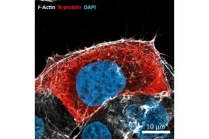 Immunofluorescence (IF) image for anti-SARS-Coronavirus Nucleocapsid Protein (SARS-CoV N) antibody (ABIN6952544)