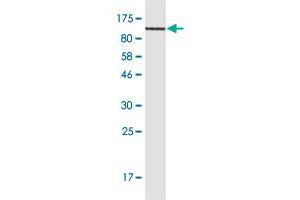 Western Blot detection against Immunogen (102. (CD44 抗体  (AA 1-699))