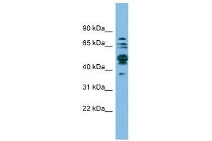 SHMT1 antibody used at 1 ug/ml to detect target protein. (SHMT1 抗体)