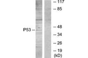 Western blot analysis of extracts from HT29 cells, using p53 (Ab-315) Antibody. (p53 抗体  (AA 281-330))