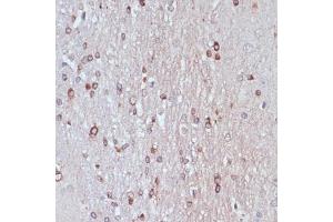 Immunohistochemistry of paraffin-embedded rat brain using TPD52 antibody  at dilution of 1:100 (40x lens). (TPD52 抗体  (AA 1-184))