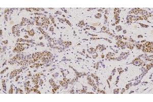 Immunohistochemistry (IHC) image for anti-Estrogen Receptor 1 (ESR1) antibody (ABIN7538886) (Estrogen Receptor alpha 抗体)