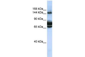 WB Suggested Anti-FAM83B Antibody Titration: 0. (FAM83B 抗体  (C-Term))