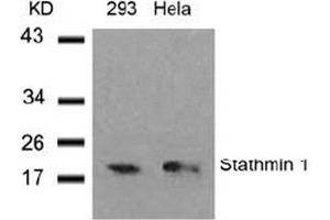 Image no. 3 for anti-Stathmin 1 (STMN1) (Ser37) antibody (ABIN197457) (Stathmin 1 抗体  (Ser37))