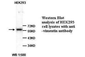 Image no. 1 for anti-Vimentin (VIM) (Internal Region) antibody (ABIN791058) (Vimentin 抗体  (Internal Region))