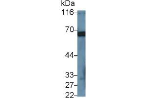 Detection of PRF1 in Rat Lung lysate using Polyclonal Antibody to Perforin 1 (PRF1) (Perforin 1 抗体  (AA 120-353))
