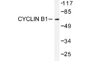 Image no. 1 for anti-Cyclin B1 (CCNB1) antibody (ABIN271880) (Cyclin B1 抗体)