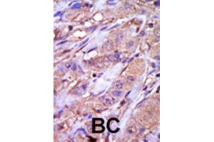 Immunohistochemistry (IHC) image for anti-Casein Kinase 1, epsilon (CSNK1E) antibody (ABIN3003191) (CK1 epsilon 抗体)