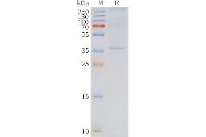 Human N-Nanodisc, Flag Tag on SDS-PAGE (NTSR1 蛋白)
