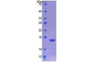 SDS-PAGE (SDS) image for Cathepsin D (CTSD) ELISA Kit (ABIN6574268)