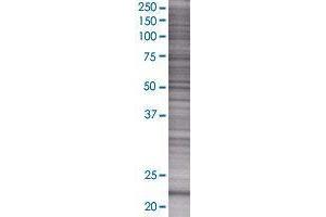 EXOSC1 transfected lysate. (EXOSC1 293T Cell Transient Overexpression Lysate(Denatured))