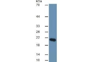 Western Blotting (WB) image for Interleukin 17F (IL17F) ELISA Kit (ABIN6574295)