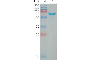 Human W Protein, hFc Tag on SDS-PAGE under reducing condition. (WFDC1 Protein (AA 32-220) (Fc Tag))