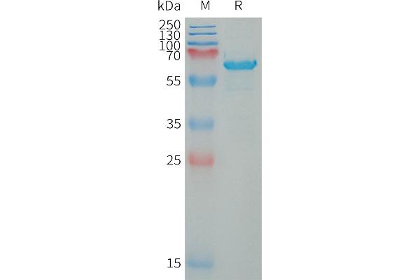 WFDC1 Protein (AA 32-220) (Fc Tag)