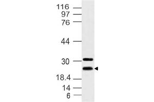 Image no. 1 for anti-Hairy and Enhancer of Split 7 (HES7) antibody (ABIN5027717) (HES7 抗体)