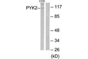 Western blot analysis of extracts from COS cells, treated with UV 15', using PYK2 (Ab-580) Antibody. (PTK2B 抗体  (AA 546-595))