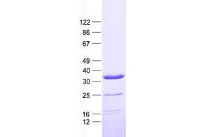 Validation with Western Blot (OTX2 Protein (His tag))