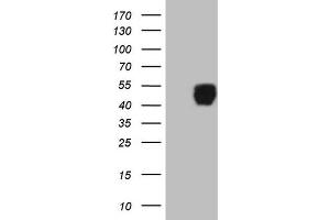 Western Blotting (WB) image for anti-Insulin-Like Growth Factor Binding Protein 3 (IGFBP3) (AA 28-297) antibody (ABIN2676168) (IGFBP3 抗体  (AA 28-297))