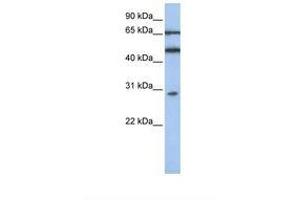 Image no. 1 for anti-Interferon-Induced Protein with Tetratricopeptide Repeats 5 (IFIT5) (AA 110-159) antibody (ABIN6739018) (IFIT5 抗体  (AA 110-159))