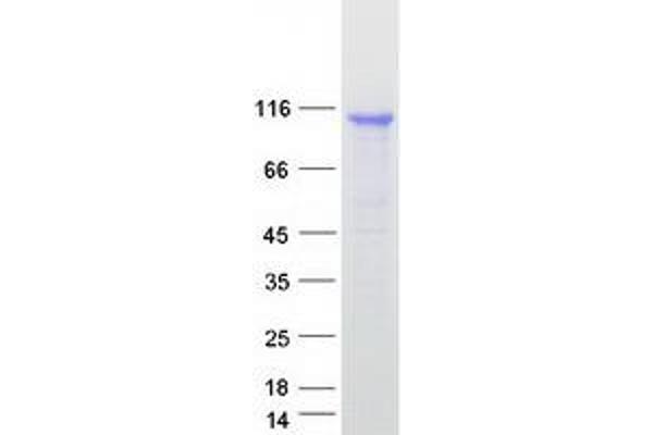 DDX58 Protein (Myc-DYKDDDDK Tag)