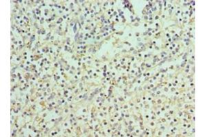 Immunohistochemistry of paraffin-embedded human spleen tissue using ABIN7166400 at dilution of 1:100 (PAD4 抗体  (AA 1-250))