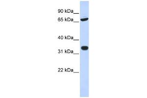 WB Suggested Anti-TRIM28 Antibody Titration:  0. (KAP1 抗体  (N-Term))