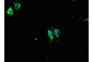 Immunofluorescent analysis of Hela cells using ABIN7165711 at dilution of 1:100 and Alexa Fluor 488-congugated AffiniPure Goat Anti-Rabbit IgG(H+L) (PKC gamma 抗体  (AA 1-314))