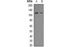 Western blot analysis of RB1 (pS807) expression in HEK293T (A), HuvEc (B) whole cell lysates. (Retinoblastoma 1 抗体  (C-Term, pSer807))