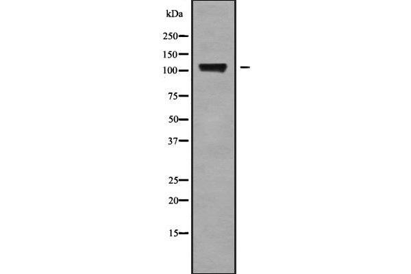 KCNH6 抗体  (C-Term)