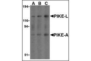 Western blot analysis of PIKE in mouse brain cell lysates with this product at (A) 0. (AGAP2 抗体  (C-Term))