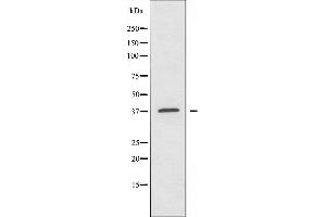 Western blot analysis of extracts from A549 cells using ALDOA antibody. (ALDOA 抗体  (N-Term))