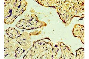 Immunohistochemistry of paraffin-embedded human placenta tissue using ABIN7150705 at dilution of 1:100 (MAP2K3 抗体  (AA 1-170))