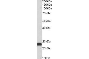 ABIN4902552 (0. (BLVRB 抗体)
