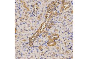 Immunohistochemistry of paraffin-embedded rat kidney using KLK5 antibody (ABIN5971539) at dilution of 1/200 (40x lens). (Kallikrein 5 抗体)