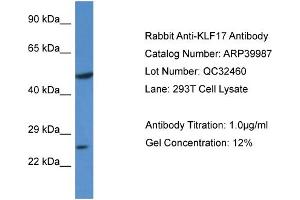 WB Suggested Anti-KLF17 Antibody Titration:  0. (KLF17 抗体  (N-Term))