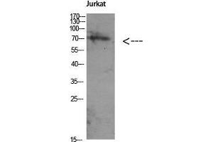 Western Blot (WB) analysis of Jurkat using Antibody diluted at 1:1000. (ATG16L1 抗体  (Internal Region))