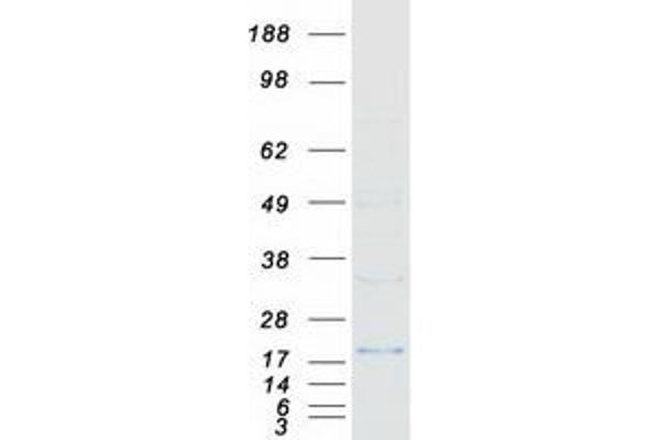 p21 Protein (Transcript Variant 2) (Myc-DYKDDDDK Tag)