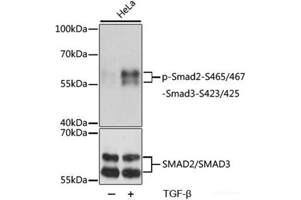 SMAD2 抗体  (pSer423, pSer425, pSer465, pSer467)