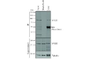 Immunoprecipitation analysis using Mouse Anti-VPS35 Monoclonal Antibody, Clone 10A8 (ABIN6932992). (VPS35 抗体  (Biotin))