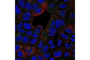 Immunofluorescence (IF) image for anti-Tumor Necrosis Factor Receptor Superfamily, Member 1B (TNFRSF1B) antibody (Biotin) (ABIN2478302) (TNFRSF1B 抗体  (Biotin))
