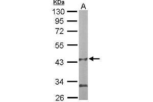 WB Image Sample (50 ug of whole cell lysate) A: mouse liver 10% SDS PAGE antibody diluted at 1:1000 (PANK1 抗体)